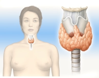 Schilddruesenkrebs